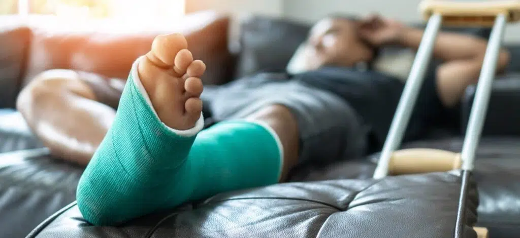 a person lying on the couch with a cast on their foot after a car accident